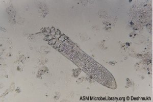 Demodex folliculorum fig1